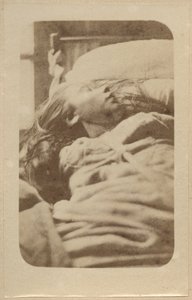 A hisztéria támadása, első fázis, illusztráció a Bourneville et P. Regnard „Iconographie Photographique de La Salpetriere” című művéből, II. tábla, Párizs, 1876 (albumnyomat)